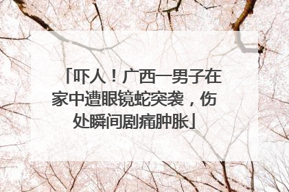 吓人！广西一男子在家中遭眼镜蛇突袭，伤处瞬间剧痛肿胀